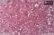 PRECIOSA Twin, dvoudirková perlička - krystal se světle růžovým průtahem